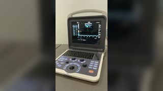 BR-US22 Ultraschallgerät