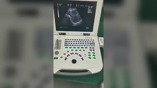 Volldigitales Laptop-Ultraschalldiagnosesystem 80element BR-US11