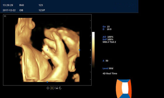 Medical Ultrasound Device 4D Portable Color Doppler Machine