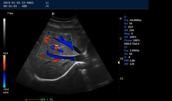 Medical Ultrasound Device 4D Portable Color Doppler Machine