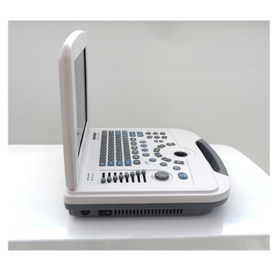 Full-Digital Laptop Ultrasound Diagnostic System 96 Element