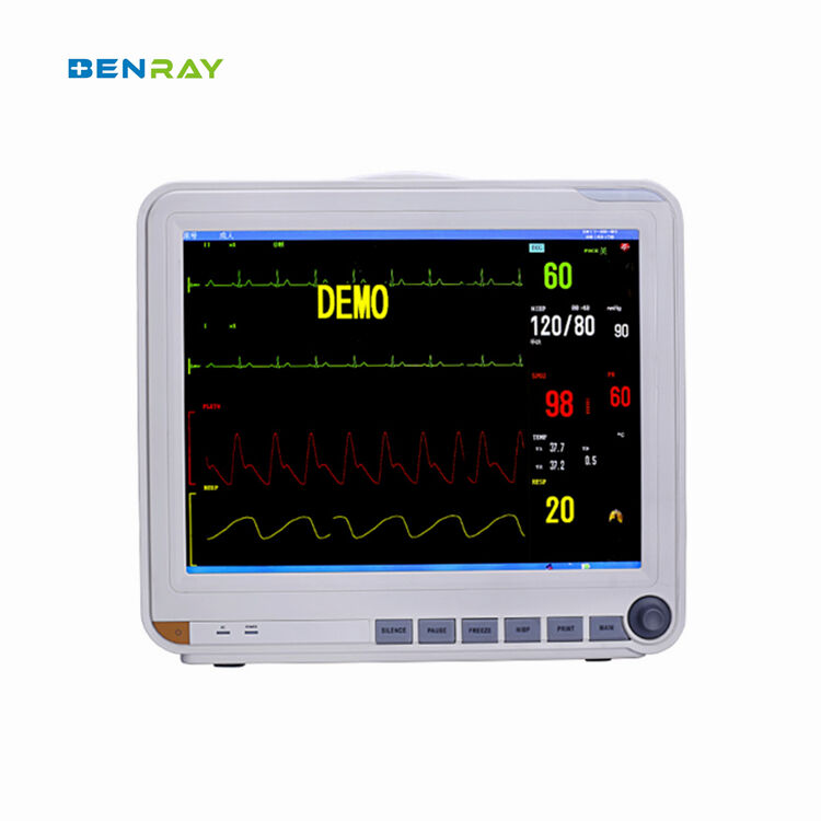 15'' Multi-Parameter Patient Monitor Surgical Medical Monitor Portable Patient Monitor