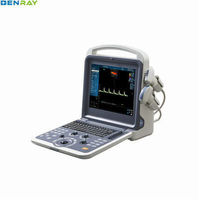 Tragbares Farbdoppler-Ultraschall-Diagnosesystem mit 80 Elementen