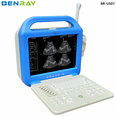 Digitales Laptop-Ultraschalldiagnosegerät für den Menschen