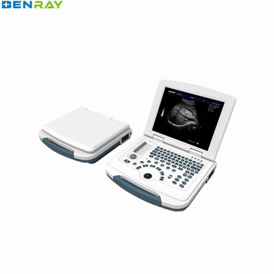 Volldigitales Laptop-Ultraschalldiagnosesystem mit 96 Elementen