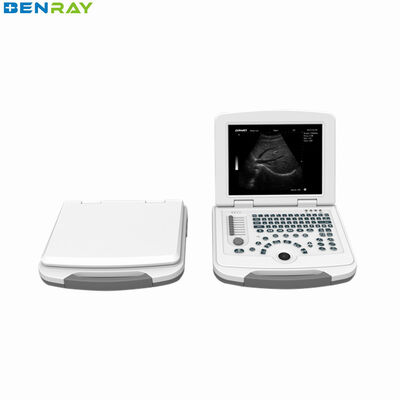 Volldigitales Laptop-Ultraschalldiagnosesystem 80element